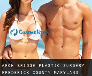 Arch Bridge plastic surgery (Frederick County, Maryland)