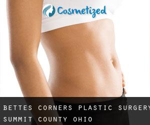 Bettes Corners plastic surgery (Summit County, Ohio)