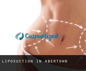 Liposuction in Abertown