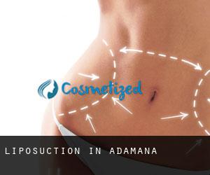 Liposuction in Adamana