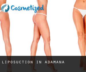 Liposuction in Adamana