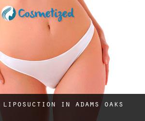 Liposuction in Adams Oaks