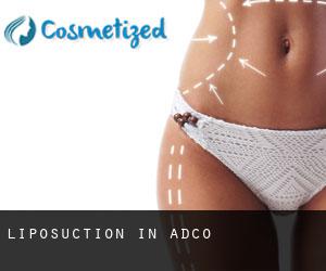 Liposuction in Adco