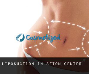 Liposuction in Afton Center