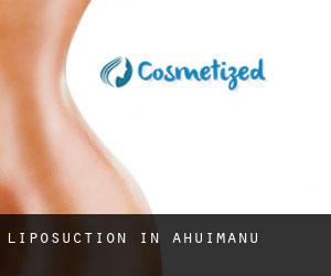 Liposuction in ‘Āhuimanu