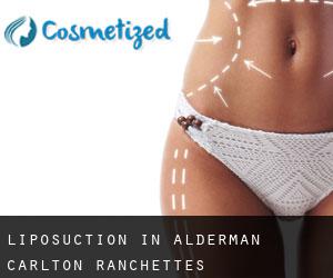 Liposuction in Alderman-Carlton Ranchettes