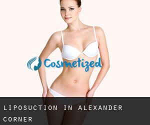 Liposuction in Alexander Corner