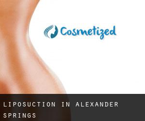 Liposuction in Alexander Springs