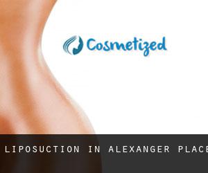 Liposuction in Alexanger Place
