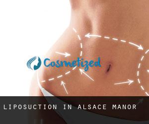 Liposuction in Alsace Manor