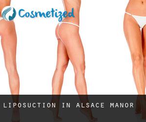 Liposuction in Alsace Manor