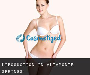 Liposuction in Altamonte Springs