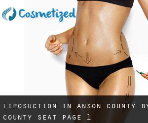 Liposuction in Anson County by county seat - page 1