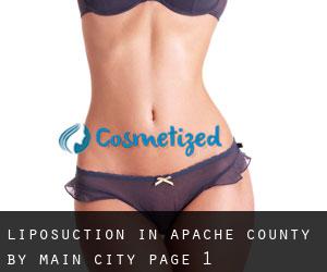 Liposuction in Apache County by main city - page 1