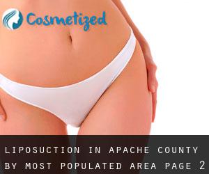 Liposuction in Apache County by most populated area - page 2