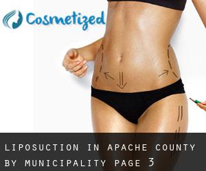 Liposuction in Apache County by municipality - page 3
