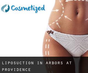 Liposuction in Arbors at Providence