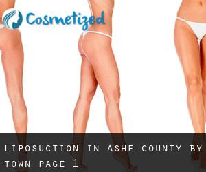Liposuction in Ashe County by town - page 1