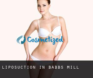 Liposuction in Babbs Mill