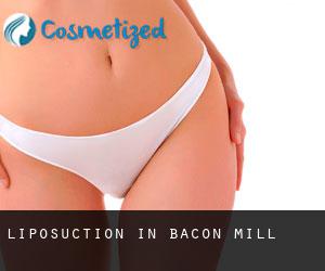 Liposuction in Bacon Mill