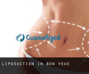 Liposuction in Bon Veue
