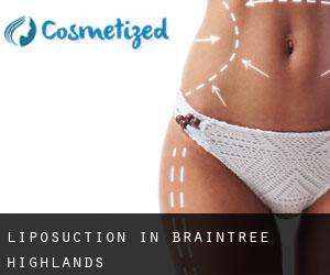 Liposuction in Braintree Highlands