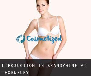 Liposuction in Brandywine at Thornbury