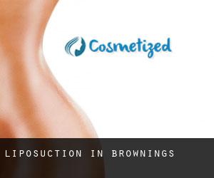 Liposuction in Brownings