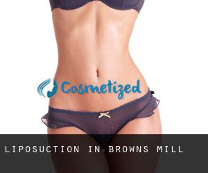 Liposuction in Browns Mill