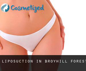 Liposuction in Broyhill Forest