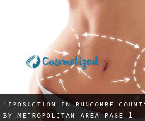 Liposuction in Buncombe County by metropolitan area - page 1