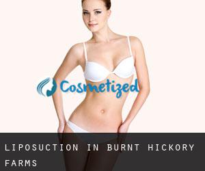 Liposuction in Burnt Hickory Farms