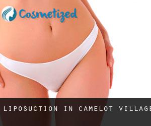 Liposuction in Camelot Village