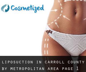Liposuction in Carroll County by metropolitan area - page 1