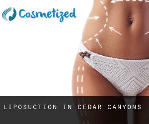 Liposuction in Cedar Canyons