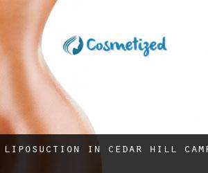 Liposuction in Cedar Hill Camp