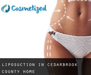 Liposuction in Cedarbrook County Home