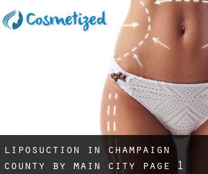 Liposuction in Champaign County by main city - page 1