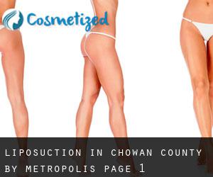 Liposuction in Chowan County by metropolis - page 1