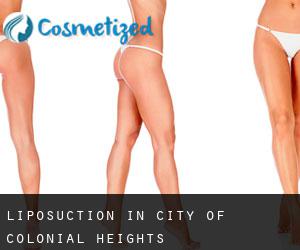 Liposuction in City of Colonial Heights