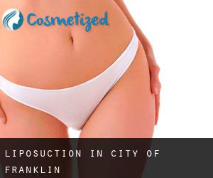 Liposuction in City of Franklin