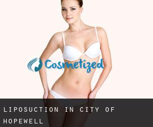 Liposuction in City of Hopewell