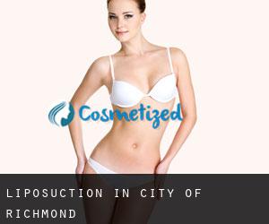 Liposuction in City of Richmond