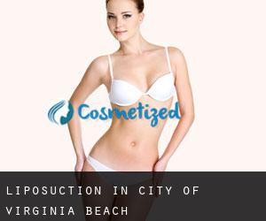 Liposuction in City of Virginia Beach