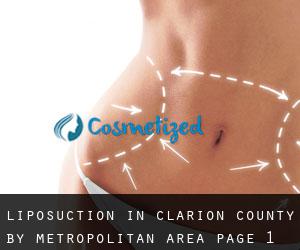 Liposuction in Clarion County by metropolitan area - page 1