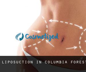 Liposuction in Columbia Forest