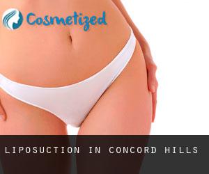 Liposuction in Concord Hills