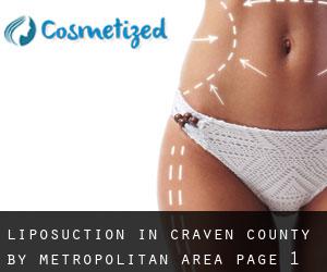 Liposuction in Craven County by metropolitan area - page 1