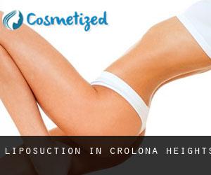 Liposuction in Crolona Heights