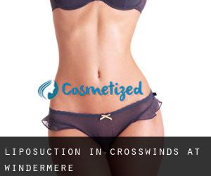 Liposuction in Crosswinds At Windermere